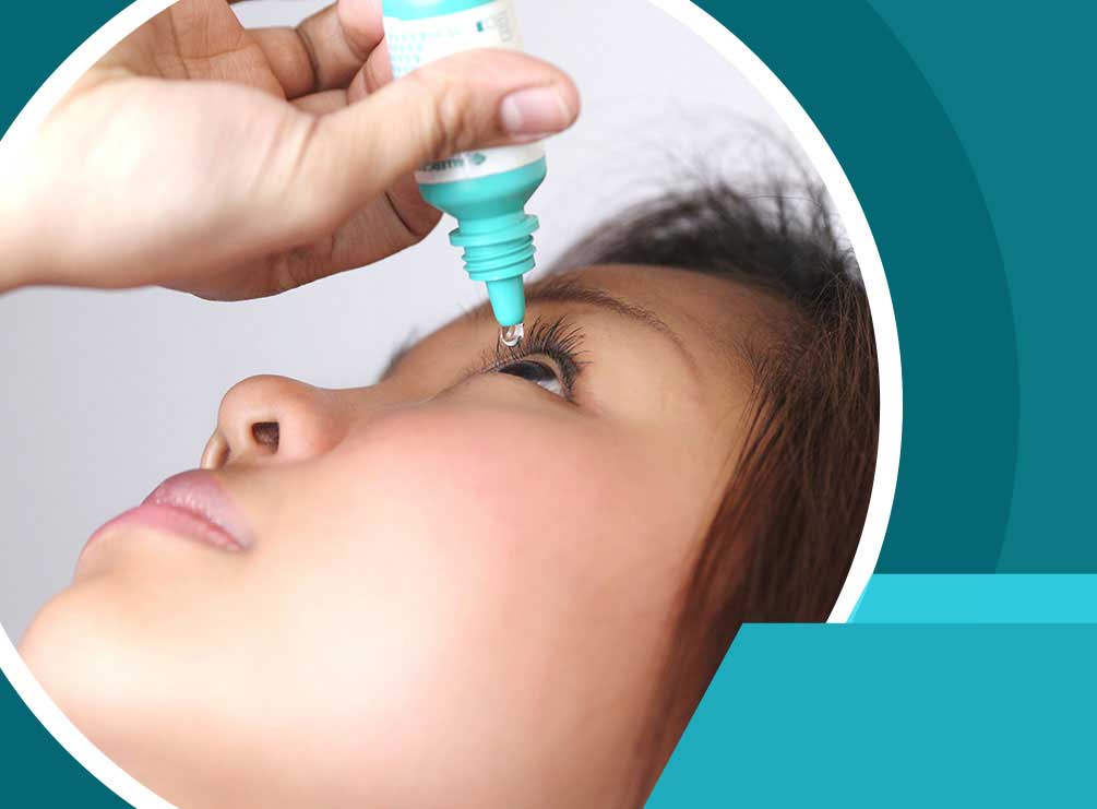 A 6-Step Guide to Applying Eye Drops