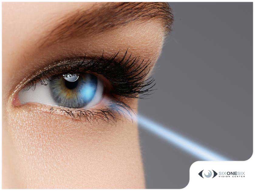 Things You Need to Know When Preparing for LASIK Eye Surgery